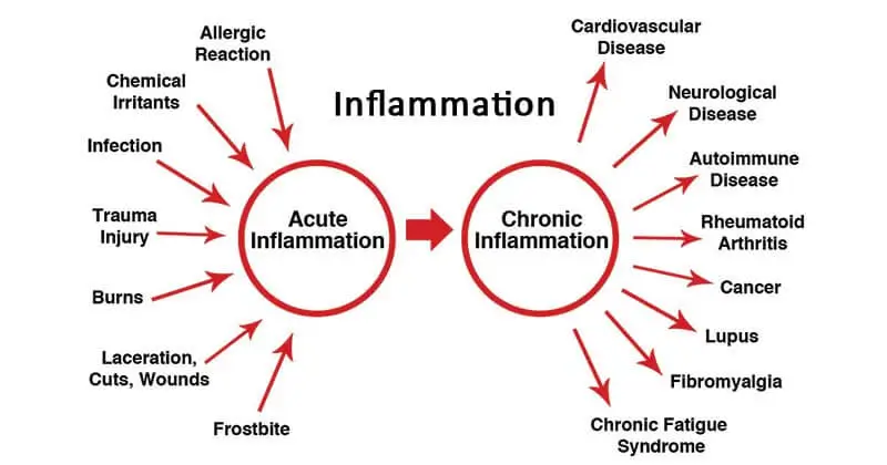 Types d'inflammation