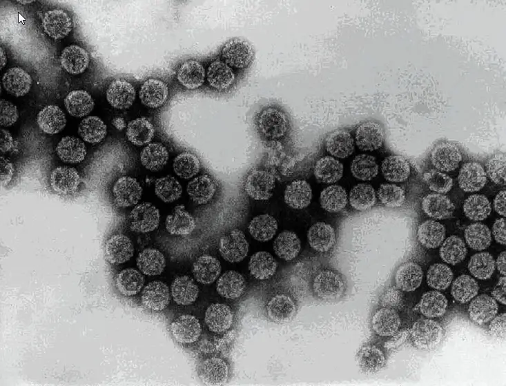 Vírus de Polioma Sv40 Micrografia electrónica de transmissão (fonte CDC)