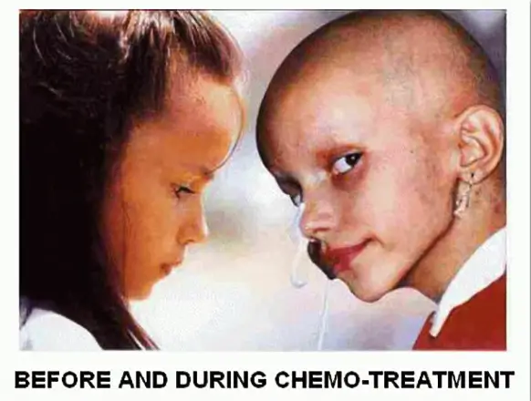Olivia_antes_y_durante_la_quimioterapia