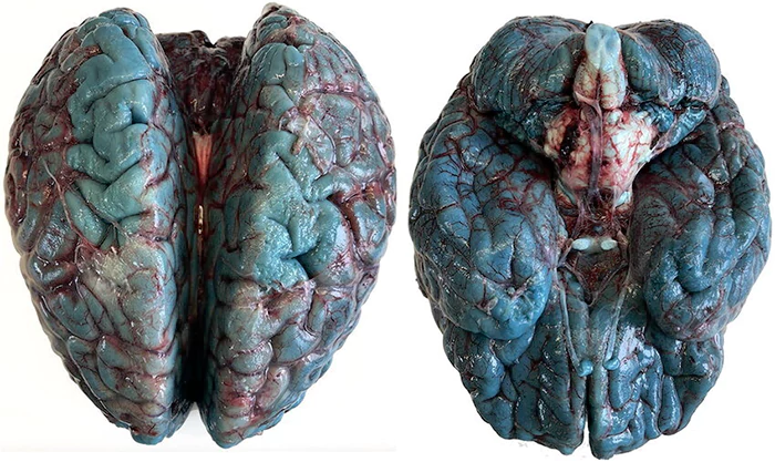 Cérebro com azul de metileno