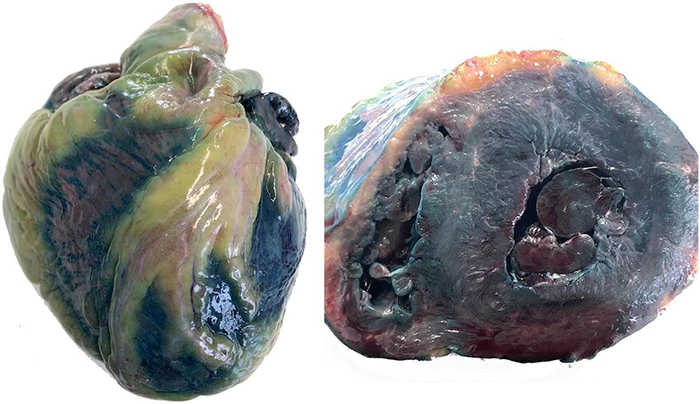 Transverse section through the ventricles show a greenish blue discoloration of the GoVeganWay.com